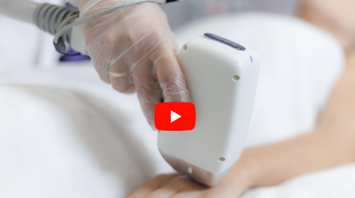 Лазерная эпиляция рук