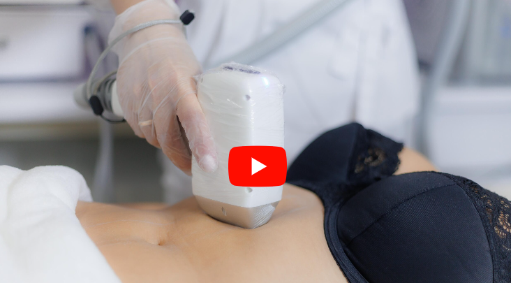 Лазерная эпиляция туловища